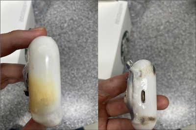 韩国发生 AirPods Pro 充电时爆炸事件，整组耳机烧到溃烂焦黑(3)
